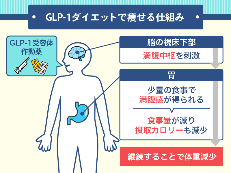 GLP-1ダイエットで痩せる仕組み