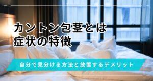 カントン包茎とは？症状や自分で見分ける方法・放置するデメリット