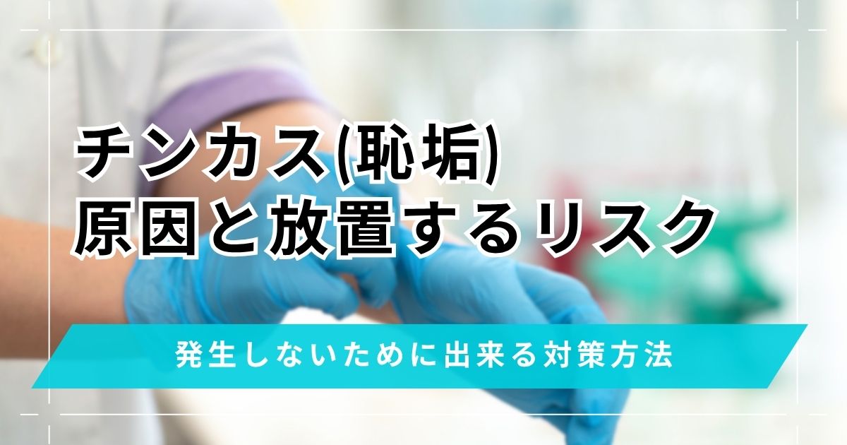 チンカス(恥垢)の原因と放置するリスク！発生しないために出来る対策方法