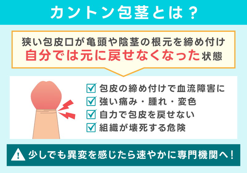 カントン包茎とは緊急性の高い病態