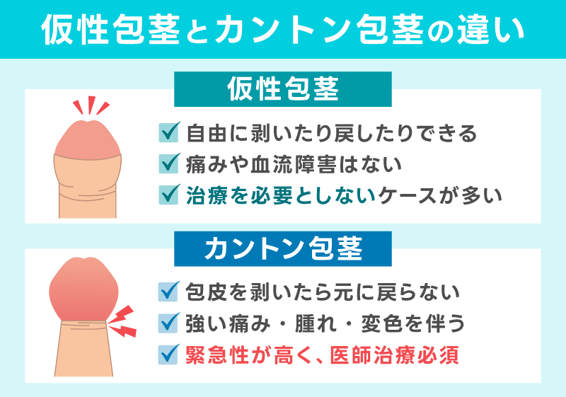 仮性包茎とカントン包茎の違い