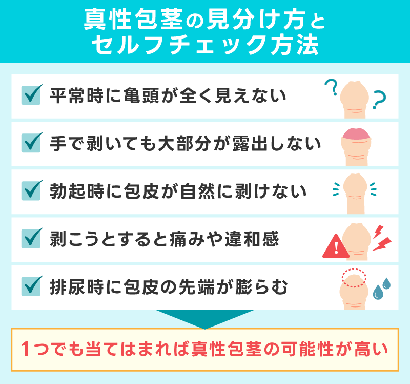 真性包茎の見分け方とセルフチェック方法